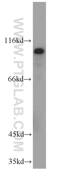 HPS4 Rabbit anti-Human, Polyclonal, Proteintech:Antibodies:Primary Antibodies