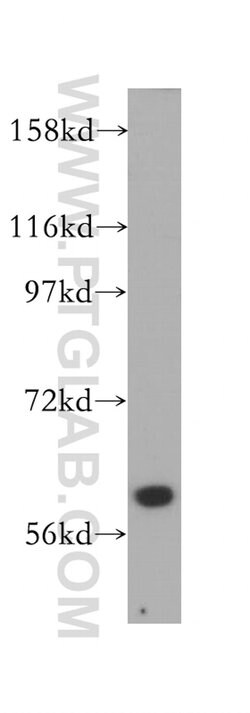 ABCB10 Rabbit anti-Human, Mouse, Rat, Polyclonal, Proteintech 150 μL;