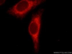 PPP1R15B Rabbit anti-Human, Mouse, Rat, Polyclonal, Proteintech:Antibodies:Primary