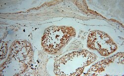 PPP1R15B Rabbit anti-Human, Mouse, Rat, Polyclonal, Proteintech:Antibodies:Primary