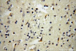 PPP1R15B Rabbit anti-Human, Mouse, Rat, Polyclonal, Proteintech:Antibodies:Primary