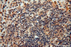 PPP1R15B Rabbit anti-Human, Mouse, Rat, Polyclonal, Proteintech:Antibodies:Primary