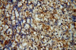 PPP1R15B Rabbit anti-Human, Mouse, Rat, Polyclonal, Proteintech:Antibodies:Primary