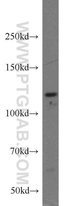PPP1R15B Rabbit anti-Human, Mouse, Rat, Polyclonal, Proteintech:Antibodies:Primary