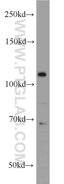 PPP1R15B Rabbit anti-Human, Mouse, Rat, Polyclonal, Proteintech:Antibodies:Primary