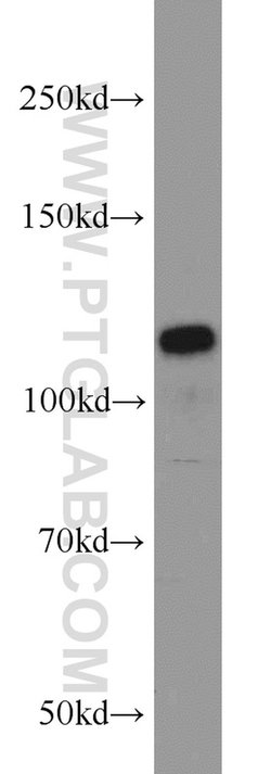 PPP1R15B Rabbit anti-Human, Mouse, Rat, Polyclonal, Proteintech:Antibodies:Primary