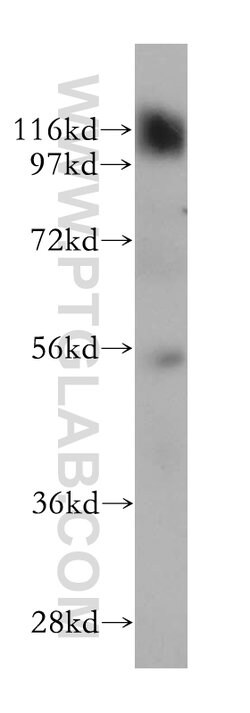 Beta adducin Rabbit anti-Human, Mouse, Rat, Polyclonal, Proteintech:Antibodies:Primary