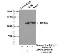 Beta adducin Rabbit anti-Human, Mouse, Rat, Polyclonal, Proteintech:Antibodies:Primary