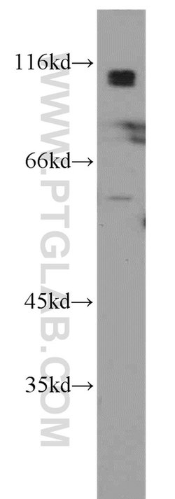 Beta adducin Rabbit anti-Human, Mouse, Rat, Polyclonal, Proteintech:Antibodies:Primary