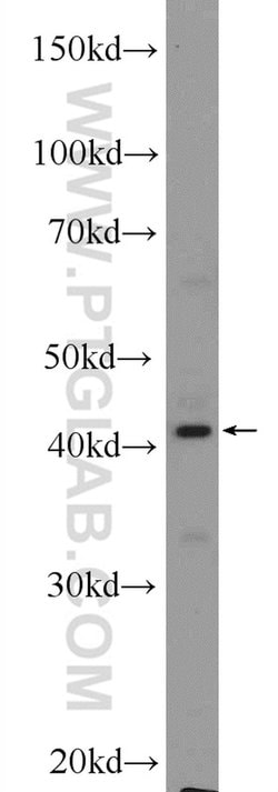 NCF4 Rabbit anti-Human, Mouse, Rat, Polyclonal, Proteintech 150 &mu;L;