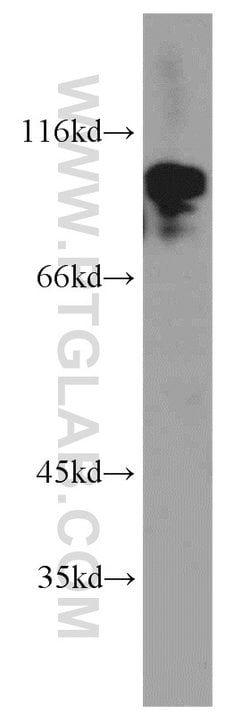 POSH Rabbit anti-Human, Mouse, Rat, Polyclonal, Proteintech 150 &mu;L;