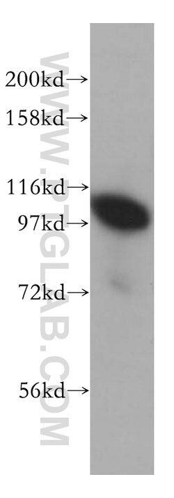 POSH Rabbit anti-Human, Mouse, Rat, Polyclonal, Proteintech 150 &mu;L;