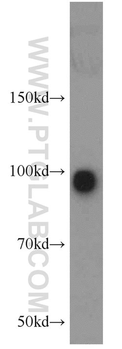POSH Rabbit anti-Human, Mouse, Rat, Polyclonal, Proteintech 150 &mu;L;