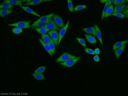RPL18A Rabbit anti-Human, Mouse, Rat, Polyclonal, Proteintech:Anticorps:Anticorps