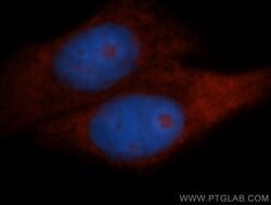 Proteintech RPL18A Rabbit anti-Human, Mouse, Rat, Polyclonal, Proteintech