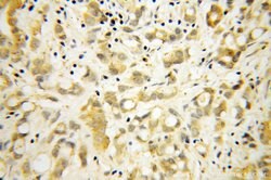 RPL18A Rabbit anti-Human, Mouse, Rat, Polyclonal, Proteintech:Anticorps:Anticorps