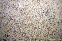 RPL18A Rabbit anti-Human, Mouse, Rat, Polyclonal, Proteintech:Anticorps:Anticorps