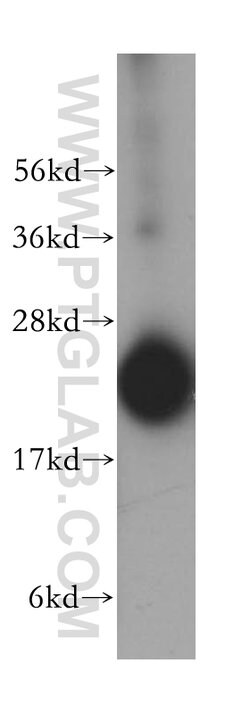 RPL18A Rabbit anti-Human, Mouse, Rat, Polyclonal, Proteintech:Anticorps:Anticorps