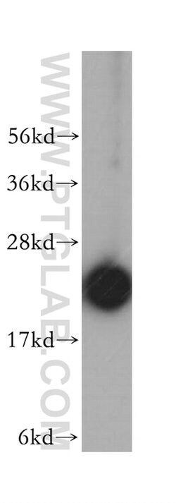 RPL18A Rabbit anti-Human, Mouse, Rat, Polyclonal, Proteintech:Anticorps:Anticorps