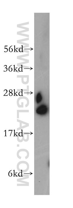 RPL18A Rabbit anti-Human, Mouse, Rat, Polyclonal, Proteintech:Anticorps:Anticorps