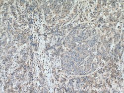 PHLDA2 Rabbit anti-Human, Polyclonal, Proteintech 150 &mu;L; Unconjugated:Anticuerpos