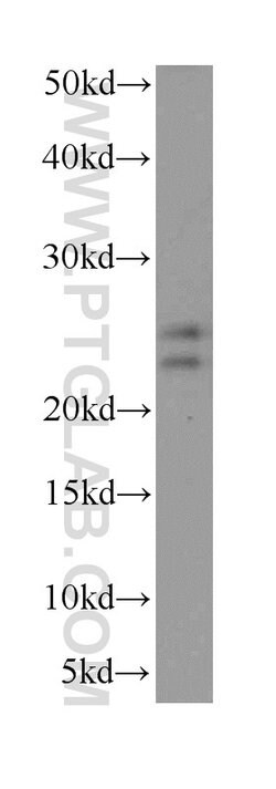 PHLDA2 Rabbit anti-Human, Polyclonal, Proteintech 150 &mu;L; Unconjugated:Anticuerpos