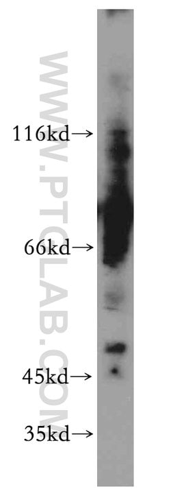 ELK4 Rabbit anti-Human, Mouse, Rat, Polyclonal, Proteintech:Antibodies:Primary