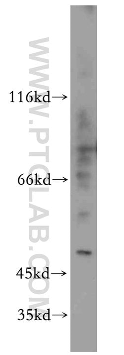 ELK4 Rabbit anti-Human, Mouse, Rat, Polyclonal, Proteintech:Antibodies:Primary