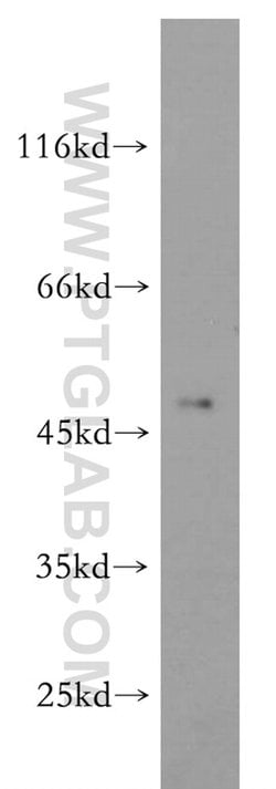 ELK4 Rabbit anti-Human, Mouse, Rat, Polyclonal, Proteintech:Antibodies:Primary