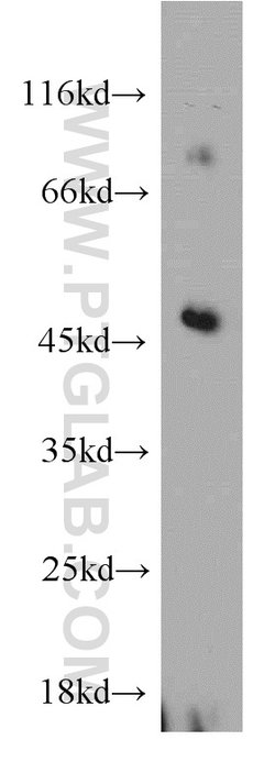 ELK4 Rabbit anti-Human, Mouse, Rat, Polyclonal, Proteintech:Antibodies:Primary