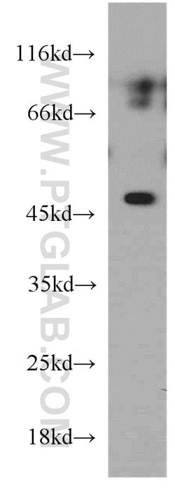 ELK4 Rabbit anti-Human, Mouse, Rat, Polyclonal, Proteintech:Antibodies:Primary
