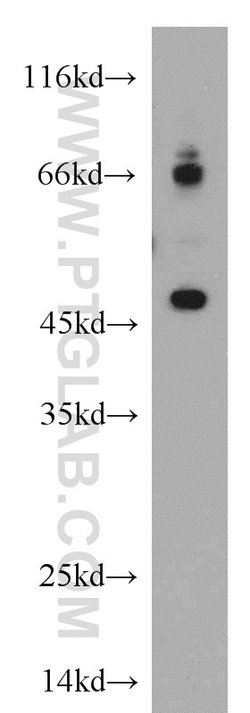ELK4 Rabbit anti-Human, Mouse, Rat, Polyclonal, Proteintech:Antibodies:Primary