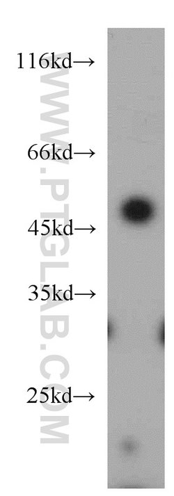 ELK4 Rabbit anti-Human, Mouse, Rat, Polyclonal, Proteintech:Antibodies:Primary