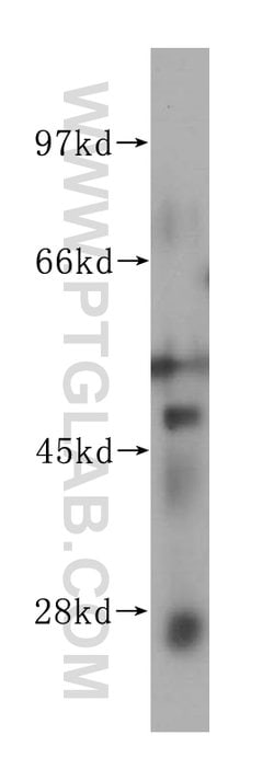ELK4 Rabbit anti-Human, Mouse, Rat, Polyclonal, Proteintech:Antibodies:Primary