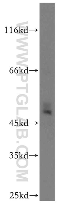 SLC25A24 Rabbit anti-Human, Mouse, Rat, Polyclonal, Proteintech:Antibodies:Primary