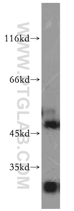 SLC25A24 Rabbit anti-Human, Mouse, Rat, Polyclonal, Proteintech:Antibodies:Primary