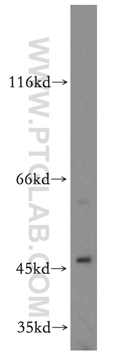 SLC25A24 Rabbit anti-Human, Mouse, Rat, Polyclonal, Proteintech:Antibodies:Primary
