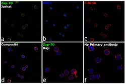 Zap-70 Monoclonal Antibody (1E7.2), eBioscience , Invitrogen:Anticuerpos:Anticuerpos