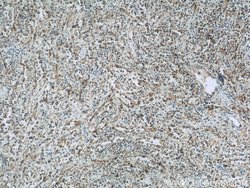 HLA-F Rabbit anti-Human, Polyclonal, Proteintech 150 &mu;L; Unconjugated:Antibodies