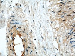 HLA-F Rabbit anti-Human, Polyclonal, Proteintech 150 &mu;L; Unconjugated:Antibodies