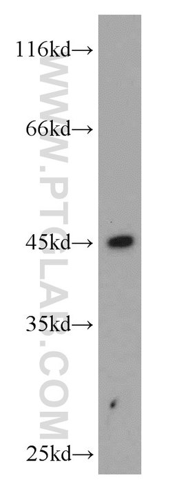 HLA-F Rabbit anti-Human, Polyclonal, Proteintech 150 &mu;L; Unconjugated:Antibodies