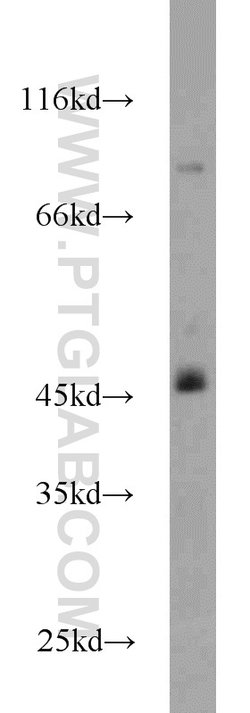 HLA-F Rabbit anti-Human, Polyclonal, Proteintech 150 &mu;L; Unconjugated:Antibodies