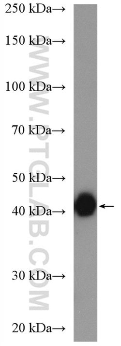 HLA-F Rabbit anti-Human, Polyclonal, Proteintech 150 &mu;L; Unconjugated:Antibodies