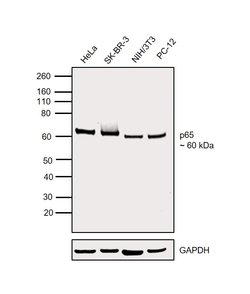 Invitrogen NFkB p65 Polyclonal Antibody, eBioscience , Invitrogen 50 &mu;g;