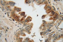 MRPL48 Rabbit anti-Human, Mouse, Rat, Polyclonal, Proteintech:Antibodies:Primary