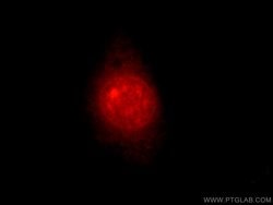 Proteintech MTA3 Rabbit anti-Human, Mouse, Rat, Polyclonal, Proteintech