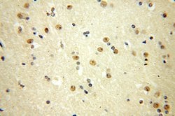 MTA3 Rabbit anti-Human, Mouse, Rat, Polyclonal, Proteintech:Antibodies:Primary