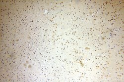MTA3 Rabbit anti-Human, Mouse, Rat, Polyclonal, Proteintech:Antibodies:Primary