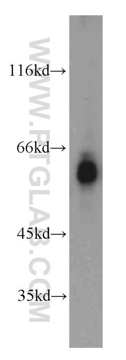 MTA3 Rabbit anti-Human, Mouse, Rat, Polyclonal, Proteintech:Antibodies:Primary