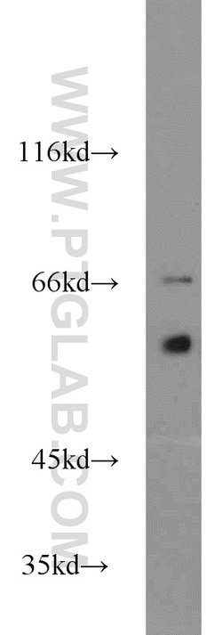 MTA3 Rabbit anti-Human, Mouse, Rat, Polyclonal, Proteintech:Antibodies:Primary